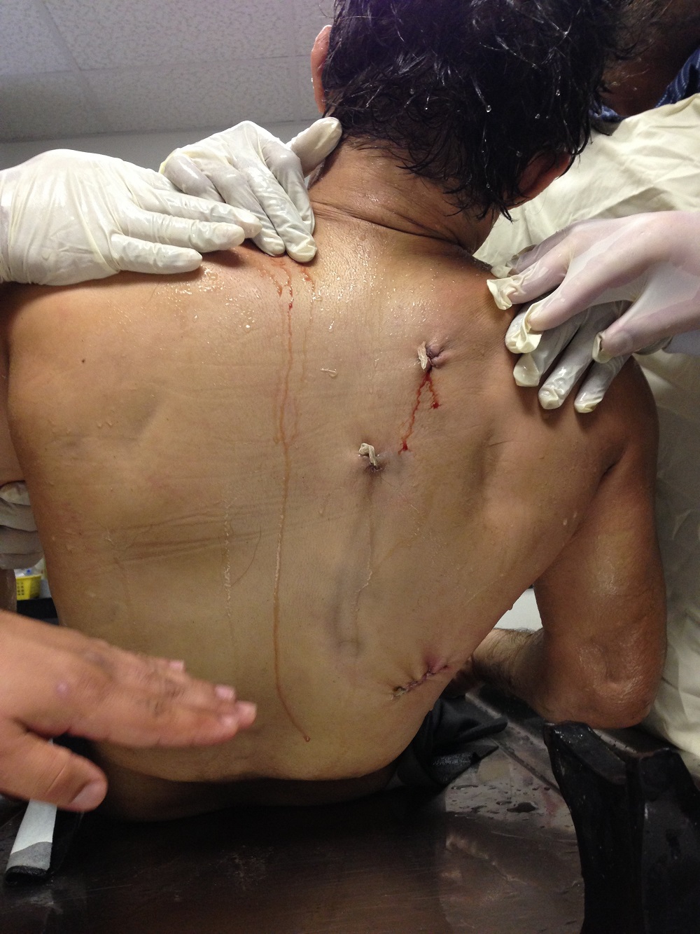 Ibragim Todashev Post-Autopsy Body Photos | Public Intelligence